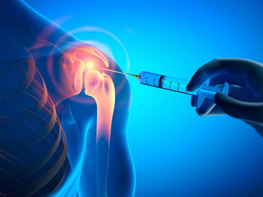 infiltrazioni alla spalla cosa sono
